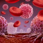 lenfoma erken teshisle buyuk oranda tedavi edilebiliyor iqqUXgJP