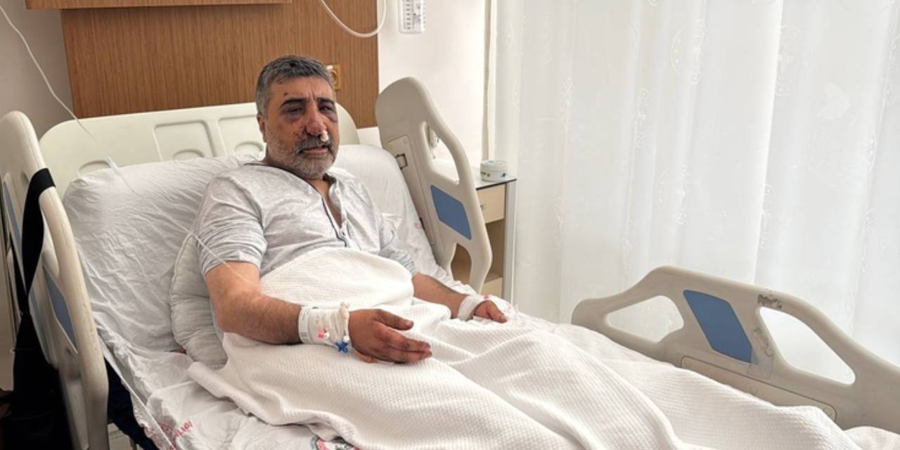 ingiliz boksorun darp ettigi taksicinin davasi goruldu geceleri bagirarak uyaniyorum akdGG2eg.jpg