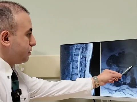 Bel Fıtığı Ameliyatı Son Çare Olmalı: Uzmanlardan Önemli İpuçları